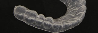矯正治療中の抜歯や虫歯治療にも対応可能