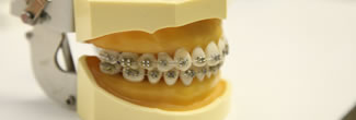 矯正治療中の抜歯や虫歯治療にも対応可能