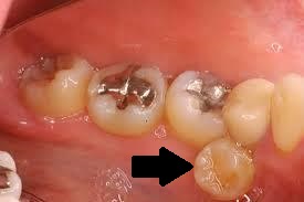 11月 18 横浜 矯正歯科 村田歯科 横浜矯正歯科センター 横浜駅前の矯正歯科専門医院